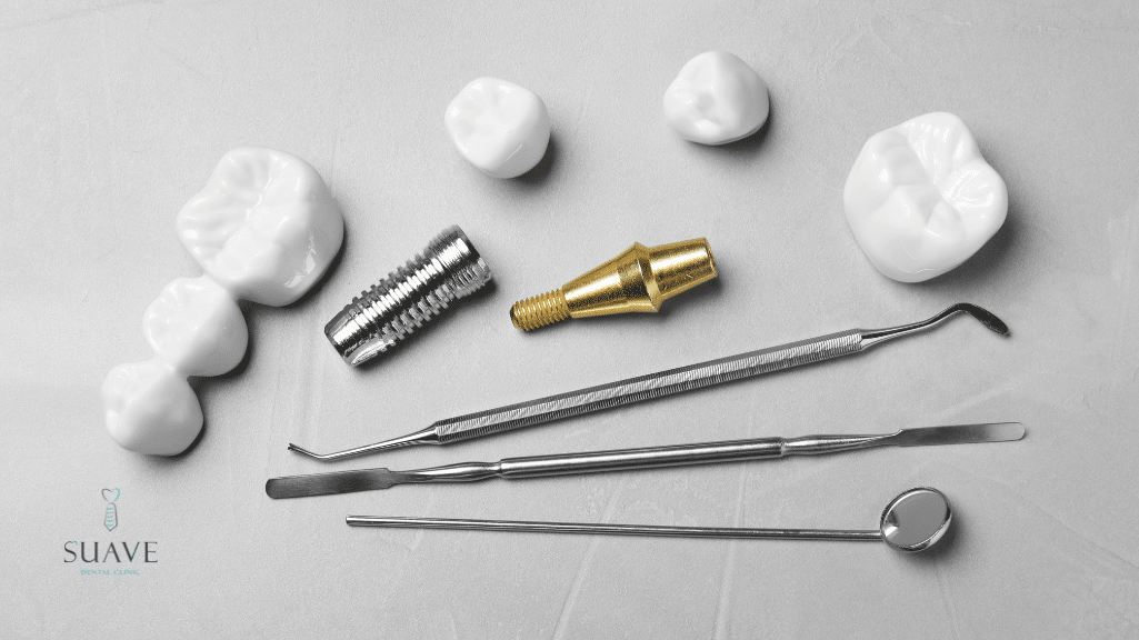 8 Alternatives To Dental Implants - Suave Dental Clinic